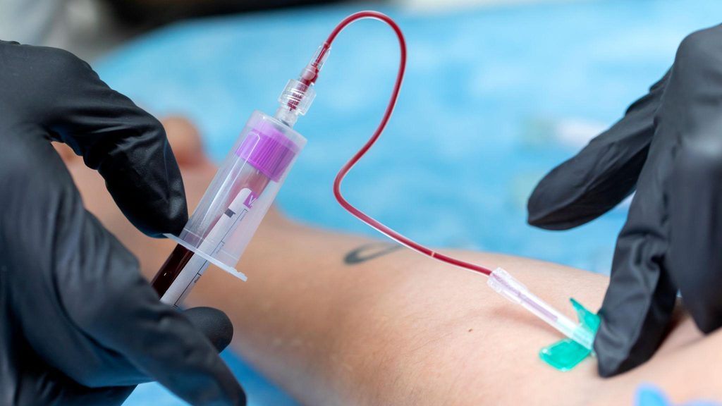 Prosedur pengambilan sampel darah vena untuk pemeriksaan hematologi di laboratorium